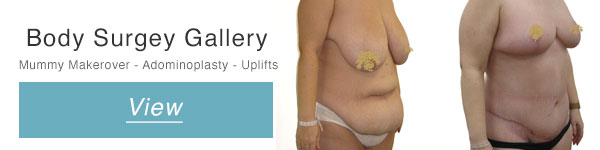 before and after body surgery mummy makeovers adminoplasty full body uplift button